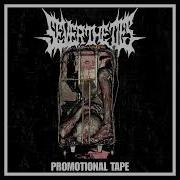 SEVER THE TIES PROMOTIONAL TAPE FULL EP