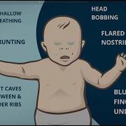 RSV In Babies What You Need To Know
