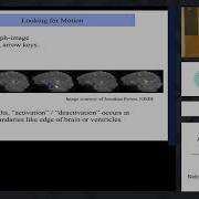 09 Alignment And Atlases Part 1 Of 2