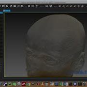 MPHY0026 Mixed Surface And Volume Rendering