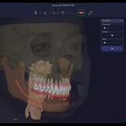 RAYFace Dynamic Occlusion Feature