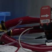 Groundbreaking First In Human Total Artificial Heart Implanted Inside Patient In Houston