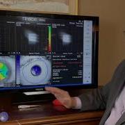 Using The ITrace Corneal MTF As A Screening Tool For MFIOL Patients