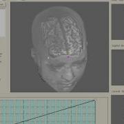 VMTK Measuring