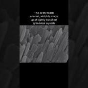 Check Out Your Teeth Under The Microscope Teeth