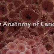 What Is Cancer What Causes Cancer How Is It Treated