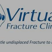 Subtle Undisplaced Fracture To Midfoot