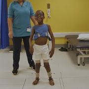 What Happens During Gait Analysis And Walking Assessments For Children