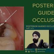 Posterior Guided Occlusion Part 1 With Dr Andy Toy