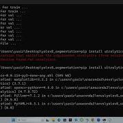YOLOv8 Instance Segmentation On Custom Dataset