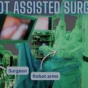 How Robot Assisted Surgery Works As Explained By A Surgeon