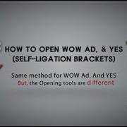 How To Properly Open And Close HUBIT Self Ligation Brackets