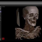 VolView Cinematic Volume Rendering