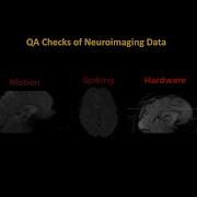 Quality Checks For FMRI Data