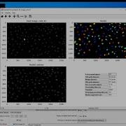 Introduction To CellProfiler By A Biologist For Biologists