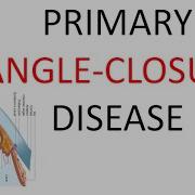 Ophthalmology Primary Angle Closure Disease Glaucoma PACG Suspect