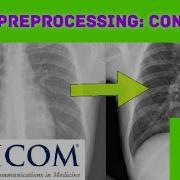 Preprocessing How To Enhance The Contrast Of DICOM Standard Images Python Programming