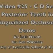 Video 25 C D Set Up Posterior Teeth In Lingualized Occlusion Demo