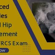 Advanced Principles Of Total Hip Replacement For The FRCS Exam Orthopaedic Academy