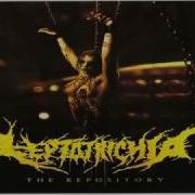 Leptotrichia Insidious Disease