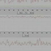 Genetic Algorithm Non Convergence Example 1