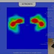 MP2506 Low Resolution Foot Pressure Mapping HDK Hardware Development Kit