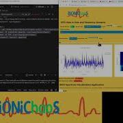 EEG Spectrogram A Python Flask EEG Analysis Tool