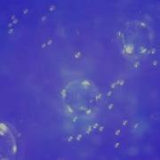SmartMicroScope Dissolving Salt At 200x Magnification