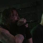 Hate5six Ringworm July 17 2018