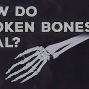 What Happens When You Break A Bone Gurpreet Baht And Natalie Pang