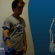 Arm 3D Motion Analysis With Inertial Sensors