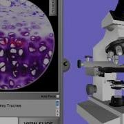 V Scope Video Instructions Mov