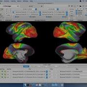 2 Wb View Surface View Basics
