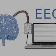 QEEG Brain Scans Explained