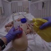 Ambu V FreeFlow Ventilation Bag