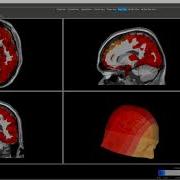 Intro NeuroNavigator NG 3 0 2