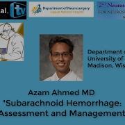 Azam Ahmed MD Subarachnoid Hemorrhage Assessment And Management