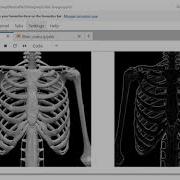 Medical Image Processing With Scikit Image Library