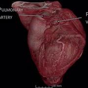 Human Organ Atlas HiP CT Imaging Of A Human Heart Using The ESRF EBS 2