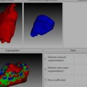 Vtk Segmentation Evaluation