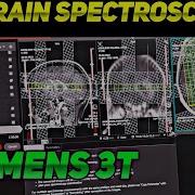 How To Do MRI BRAIN SPECTROSCOPY SPECTROSCOPY IN SIEMENS MRI BRAI SPECTROSCOPY KAISE KRTE HAIN
