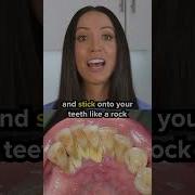 Dental Tartar Vs Dental Plaque Shorts