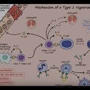 Type I Hypersensitivity Mechanism Described Concisely