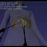 Surgical Simulation With Rigid Body Position Based Dynamics