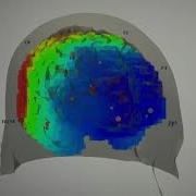 3D LORETA Brain