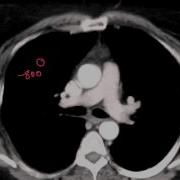 Understanding CT Windows Levels And Densities