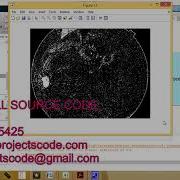 Matlab Code For Retinal Image Quality Analysis For Automatic Diabetic Retinopathy Detection