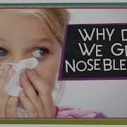 Why Do We Get Nosebleeds