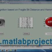 Iris Recognition Image Processing Matlab Projects