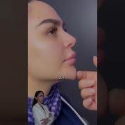 Гипер тюнинг коррекция подбородка филлером какому подходит филлеры подбородок губымосква